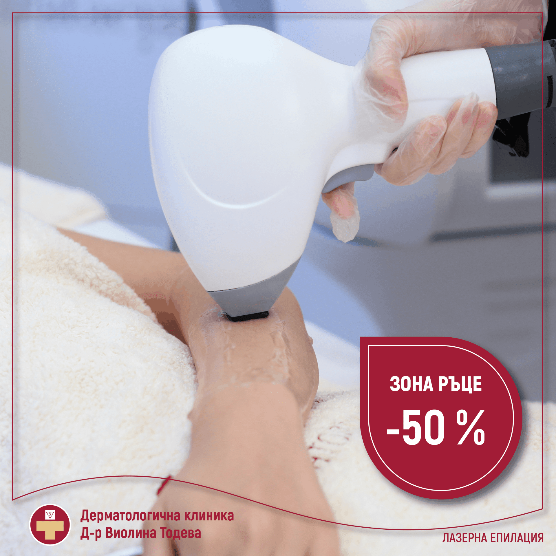 Лазерна епилация