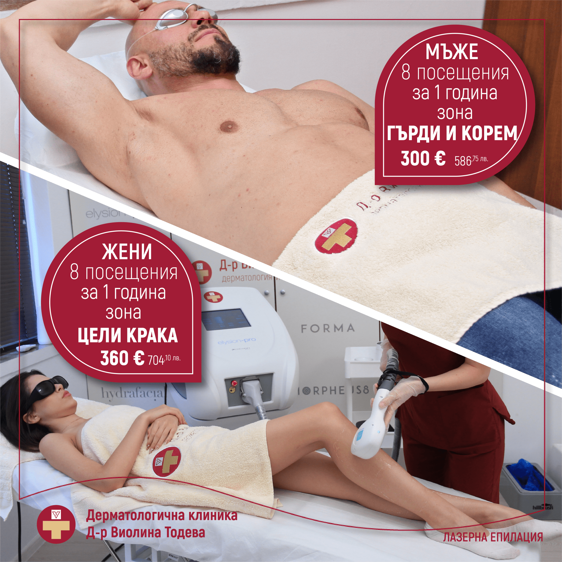 Лазерна епилация