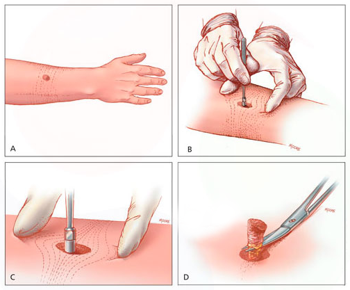 Как протича манипулацията?