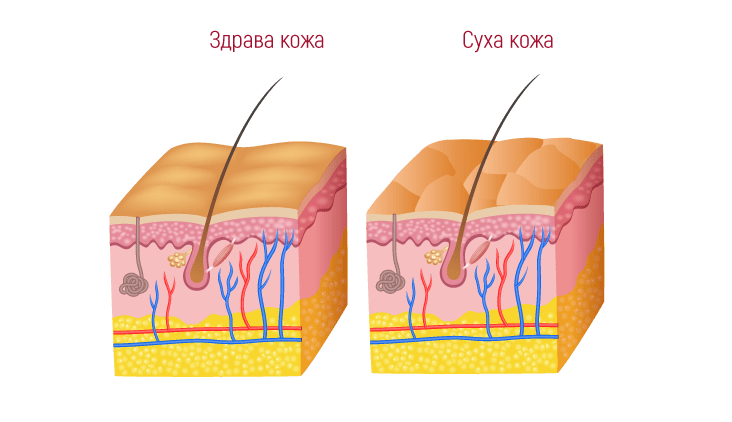 Какво е ксероза?