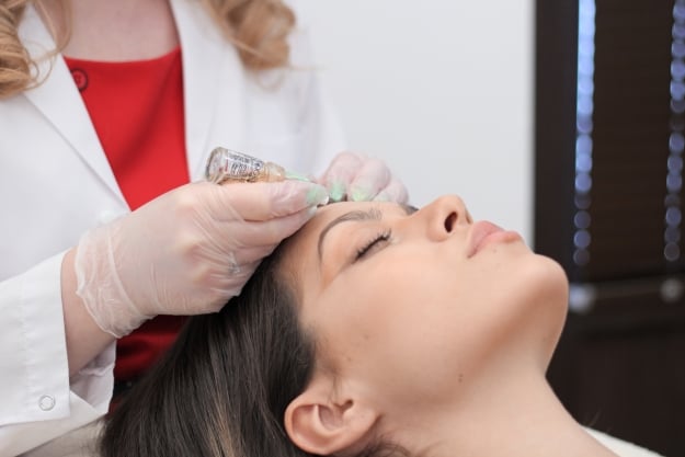 Ексфолиация