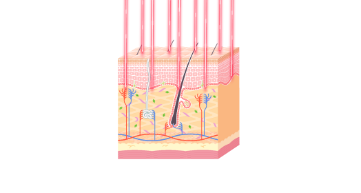 Какво е LUMECCA?