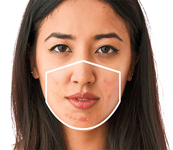 Как се отразява носенето на маска върху състоянието на кожата на лицето?