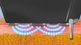 Какво е Forma?