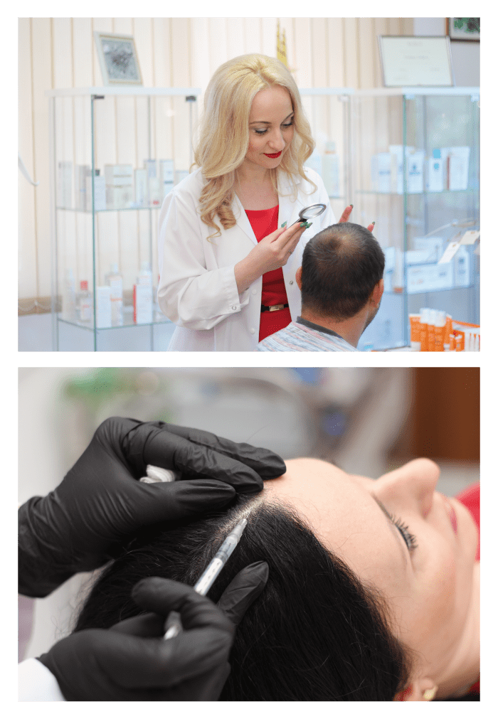 При кои състояния се препоръчва мезотерапия за коса?