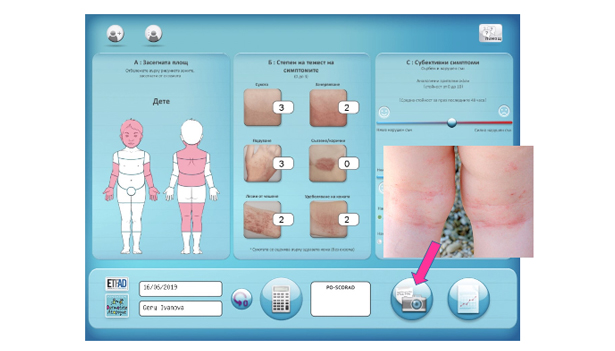 Какво е PO-SCORAD?