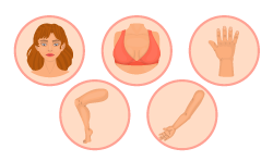 Кои зони може да се третират?