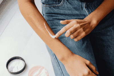 Локални кортикостероиди при кожни болести