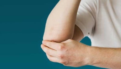 Псориазисът и неговата социална значимост - интервю на д-р Виолина Тодева